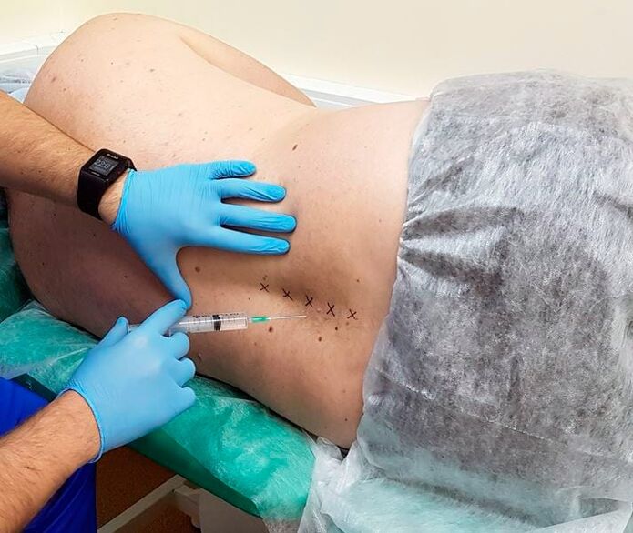 blocs médicinaux pour le dos