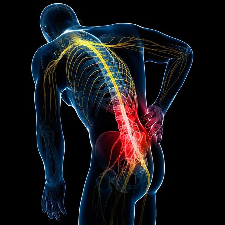 causes des maux de dos